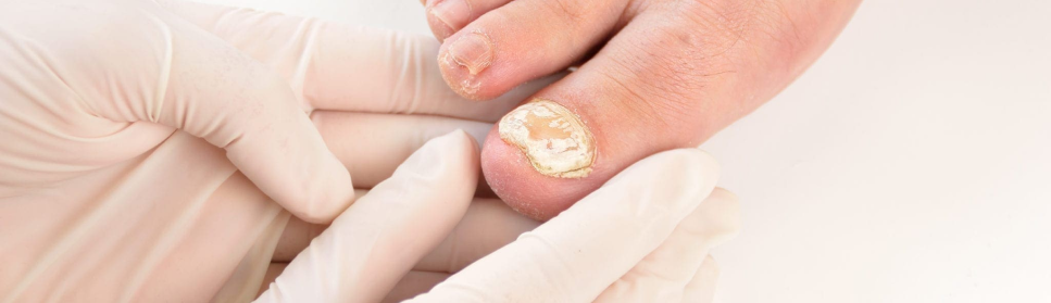 Treatment Image