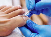 Surgical Removal