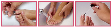 Step-by-Step Treatment
