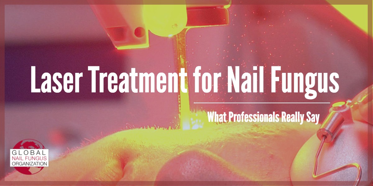 Laser Treatment for Nail Fungus