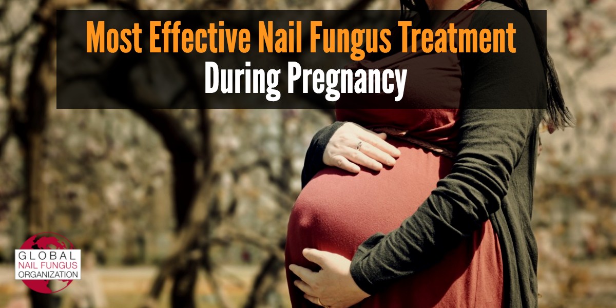 Most Effective Nail Fungus Treatment During Pregnancy