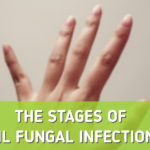 the-stages-of-nail-fungal-infections