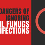The Dangers of Ignoring Toenail Fungus Infections