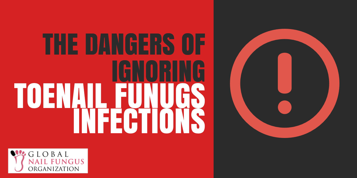 The Dangers of Ignoring Toenail Fungus Infections