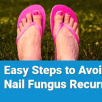5-easy-steps-to-avoid-nail-fungus-recurrence1