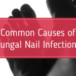 common-causes-of-fungal-nail-infections
