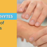 dermatophytes_-the-cause-of-nail-fungu