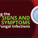 detecting-early-signs-and-symptoms-of-nail-fungal-infections