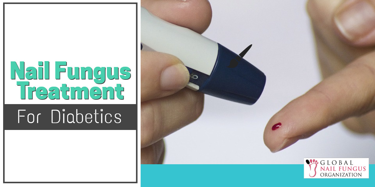 nail-fungus-treatment-for-diabetics