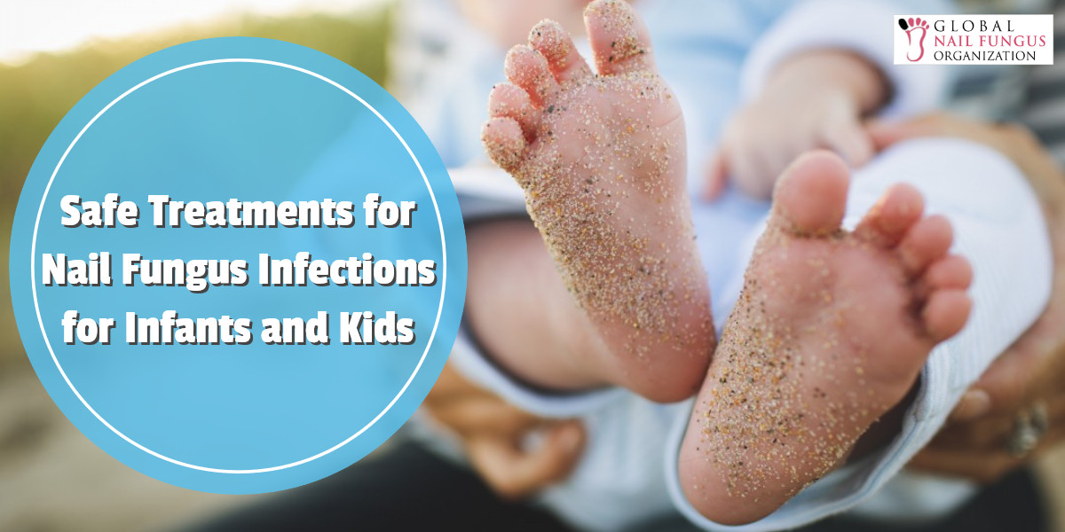 Safe Treatments for Nail Fungus Infections for Infants and Kids | GNFO
