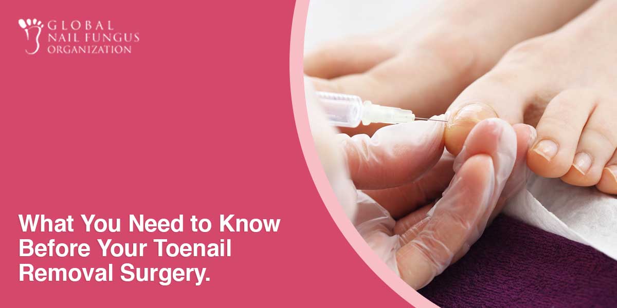 What You Need to Know Before Your Toenail Removal Surgery